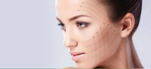 Microneedling Treatment: A Complete Guide to Renewing Your Skin