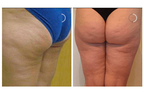 Treatment result