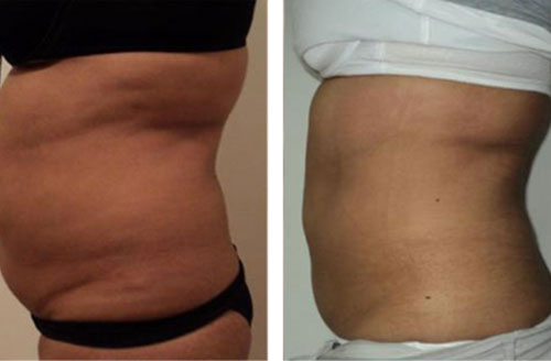 Treatment result