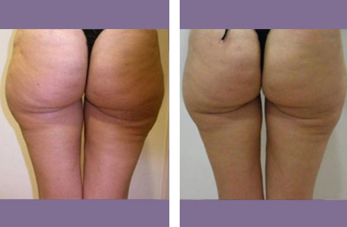 Treatment result