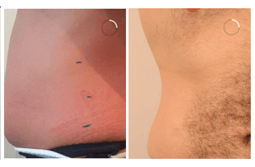 Treatment result