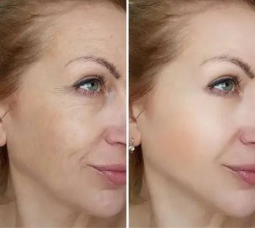 Treatment result