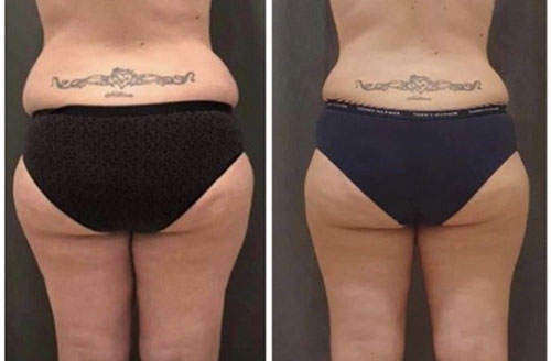 Treatment result