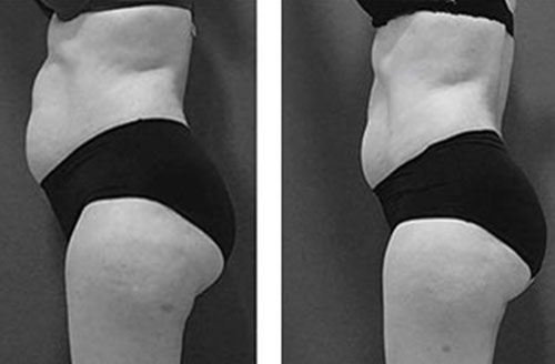 Treatment result